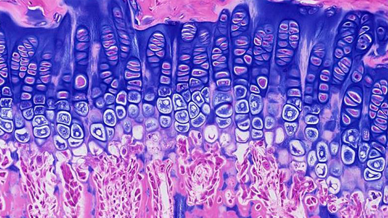 Microscopic image of growth plate cartilage showing layered chondrocytes stained in purple and pink.