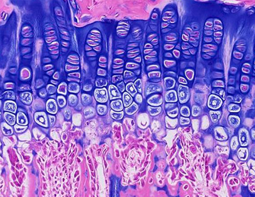 Microscopic image of growth plate cartilage showing layered chondrocytes stained in purple and pink.