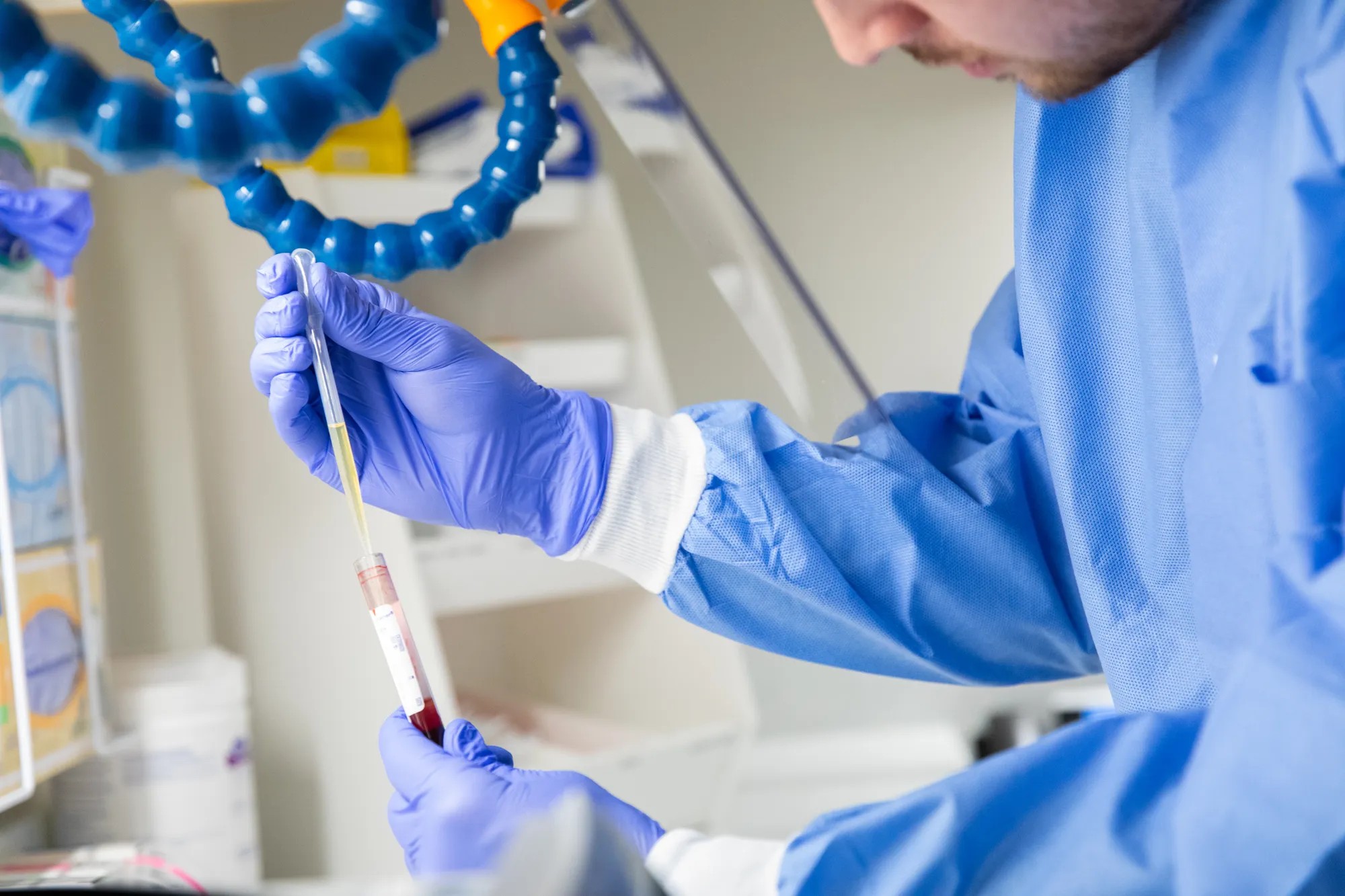 A person wearing protective gloves and a blue lab coat carefully handles a test tube containing a blood sample in a laboratory setting.