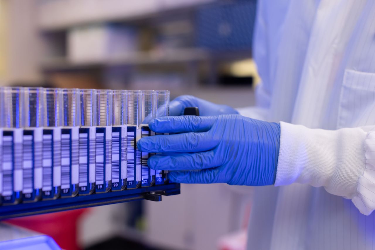 Genetic testing for SMA 