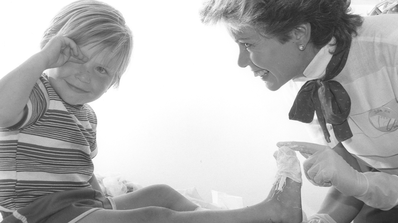 A burn patient receives care in the 1980s