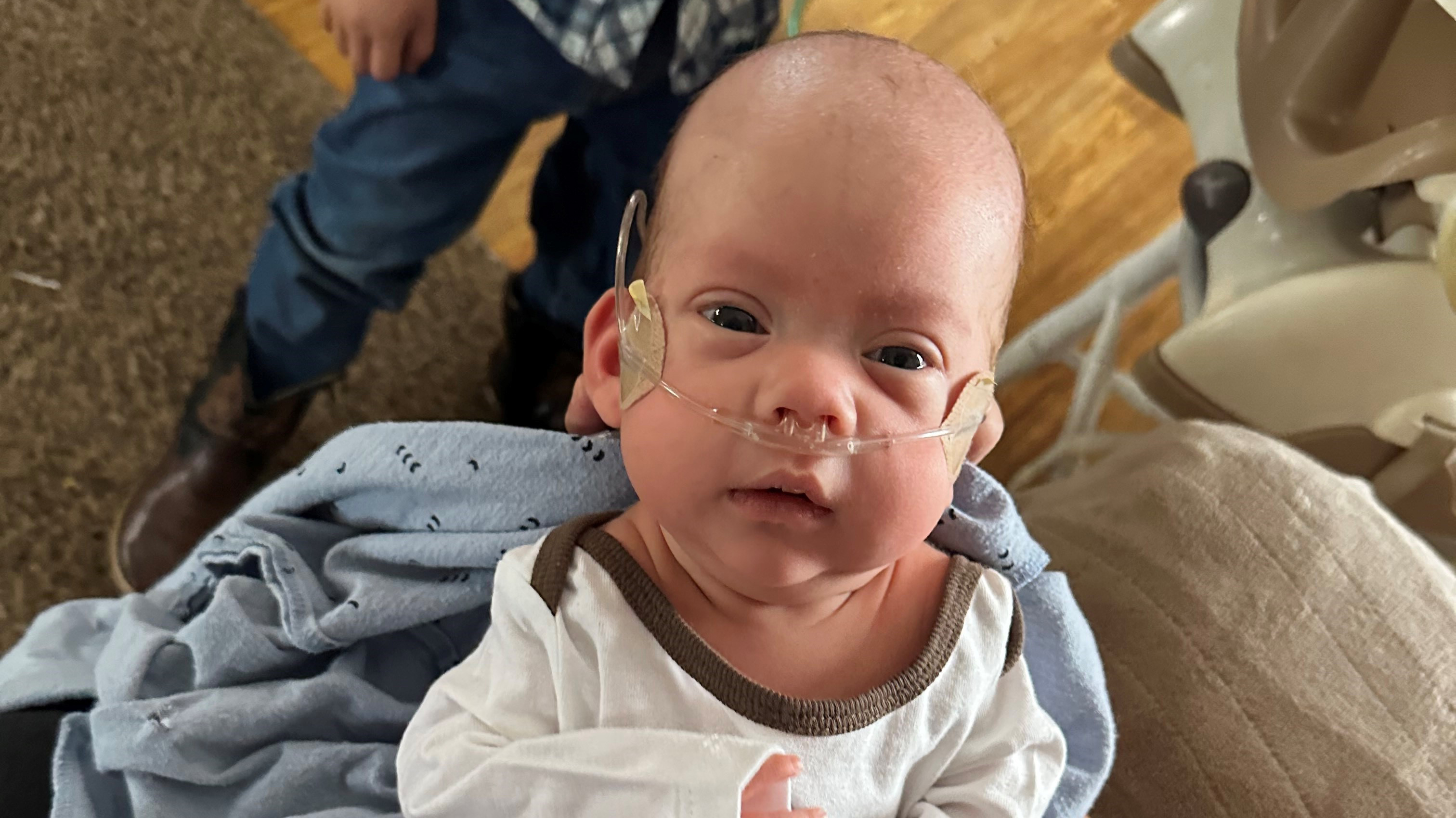 Baby Emilio looks at the camera while wearing oxygen.