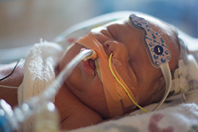 Noah gets treatment at Children's Hospital Colorado for lymphangioma.