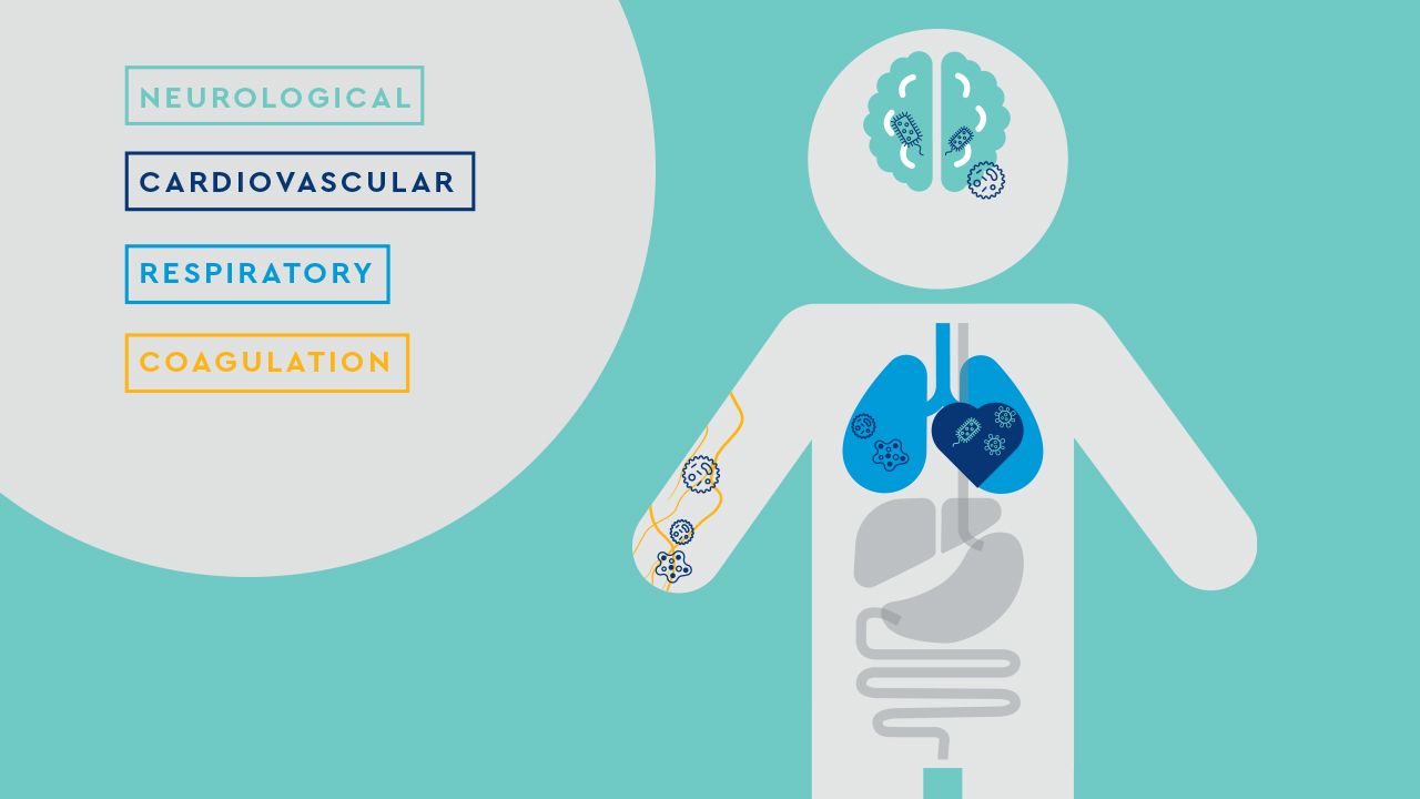 A grey illustration of a person on a mint green background with illustrated brain, heart, lungs, blood vessels and other organs in various colors. On the left side appear the words: neurological, cardiovascular, respiratory, coagulation.