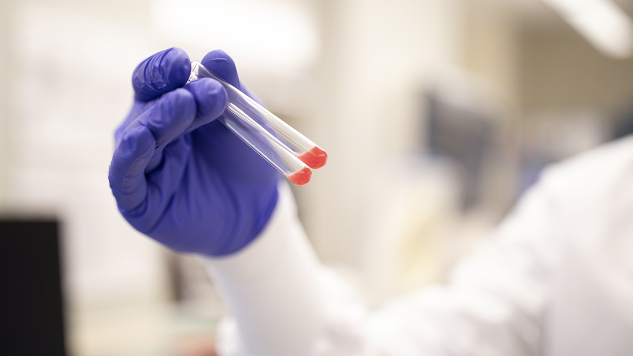A gloved hand in a laboratory holds two test tubes that contain a small amount of blood.