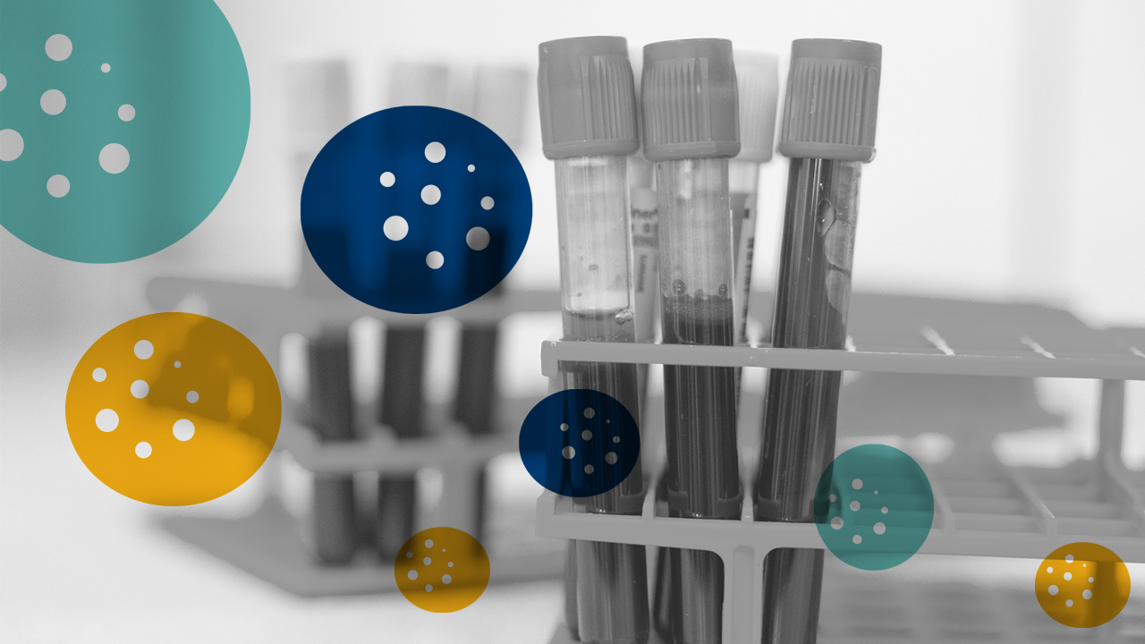 Test tubes in a lab rack, partially filled with liquid, shown in grayscale. Overlaid by colorful circular graphics in teal, blue and gold representing viruses.