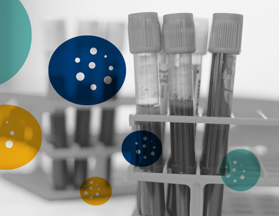 Test tubes in a lab rack, partially filled with liquid, shown in grayscale. Overlaid by colorful circular graphics in teal, blue and gold representing viruses.