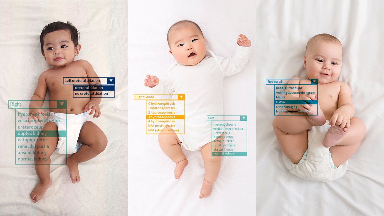 EPIC module showing babies laying on their back.
