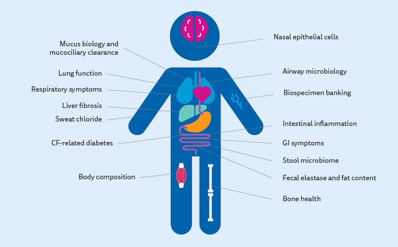 DHI_Narkewicz_CF Liver Disease-graphics-2.jpg